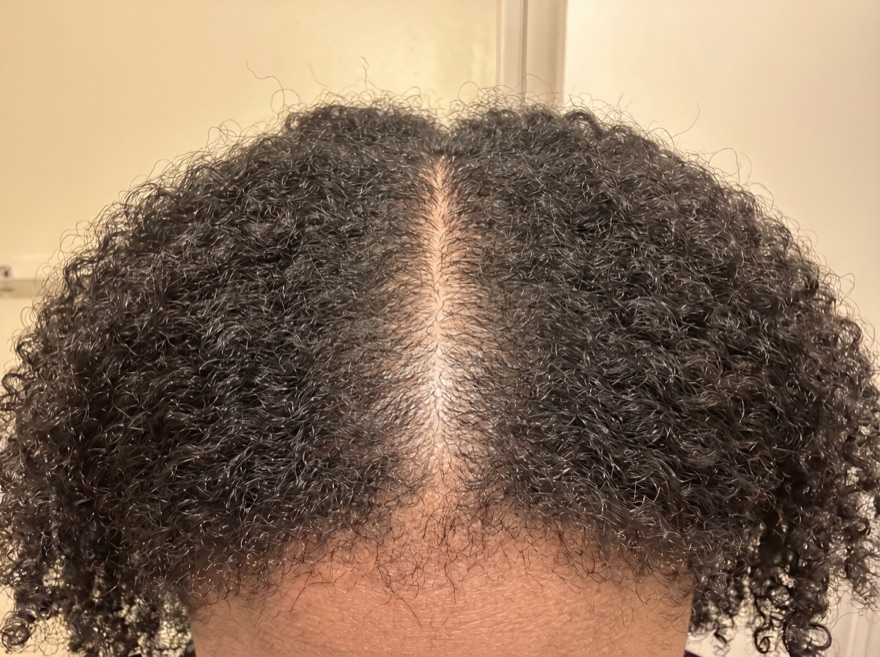 Before — center part, natural coily hair