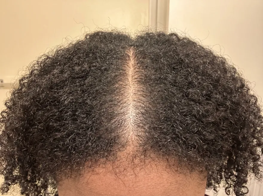 Before — center part, natural coily hair