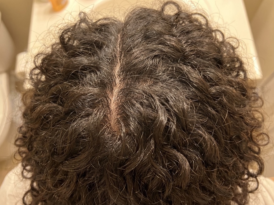 After 90 days — crown, curly dark hair