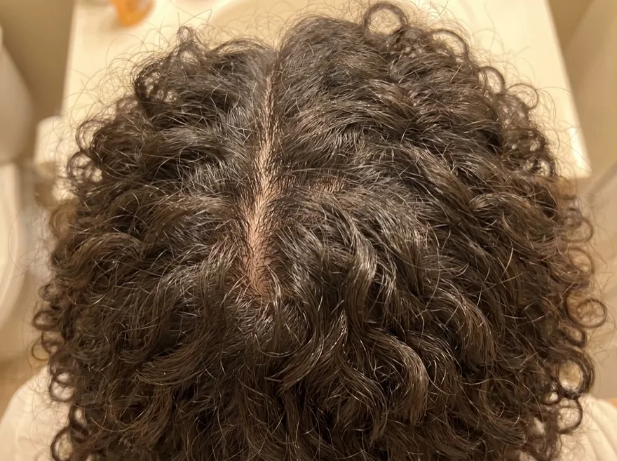After 90 days — crown, curly dark hair