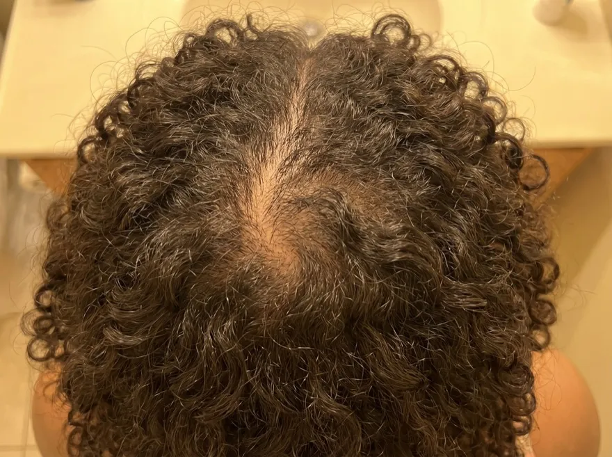 Before — crown, curly dark hair