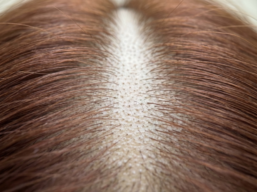Before — part line, reddish hair