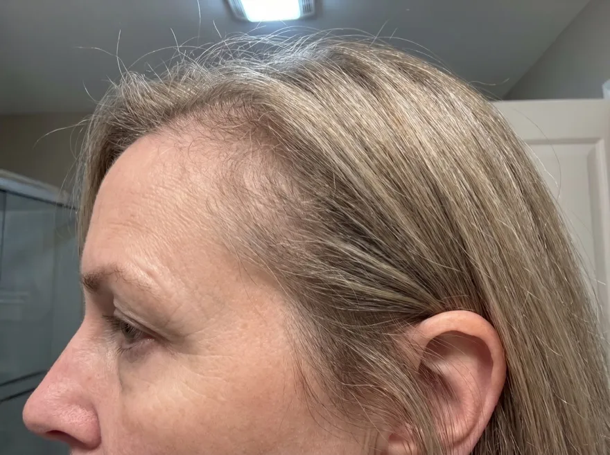 Before — temple, ash blonde hair