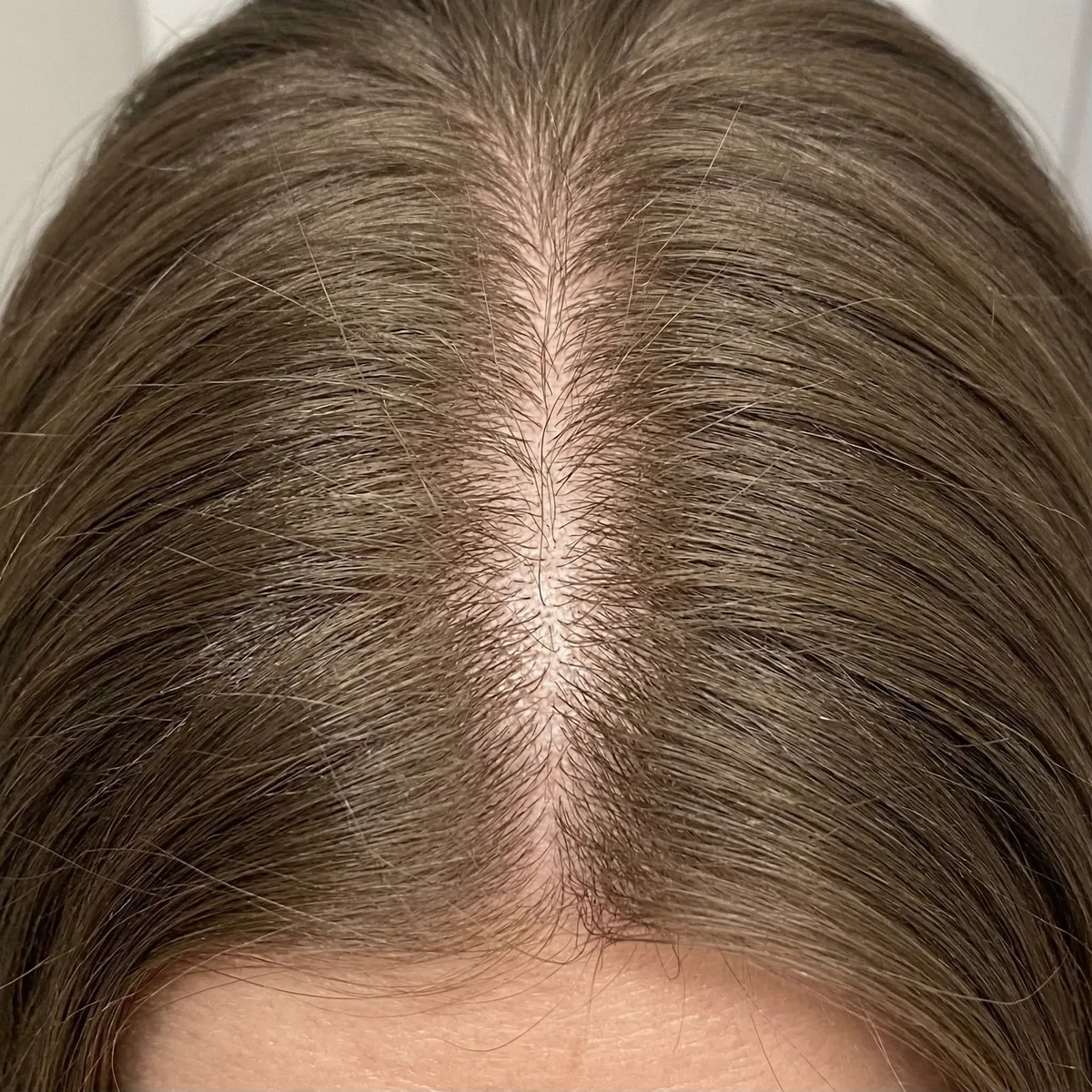 After — Day 90
