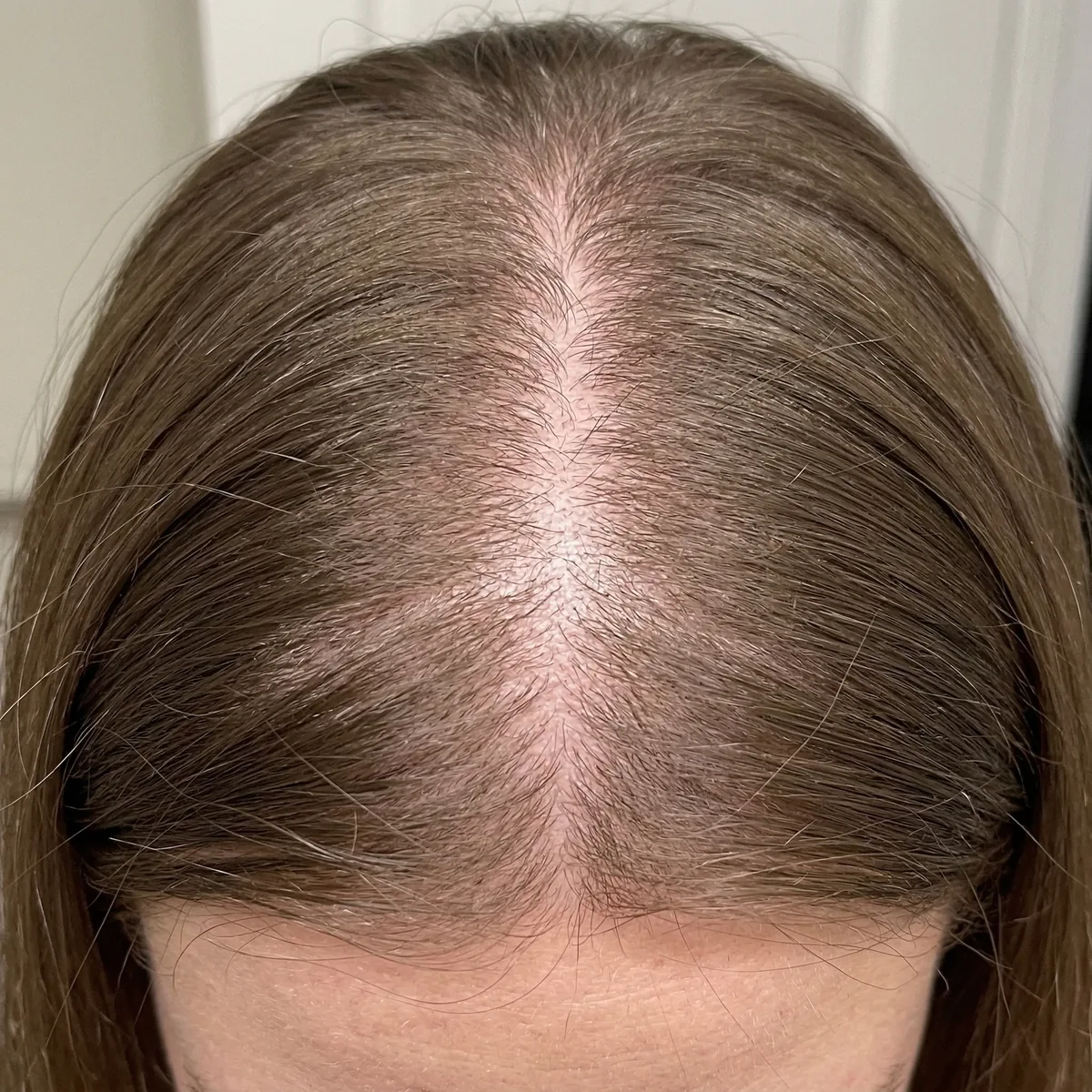 Before — Day 1