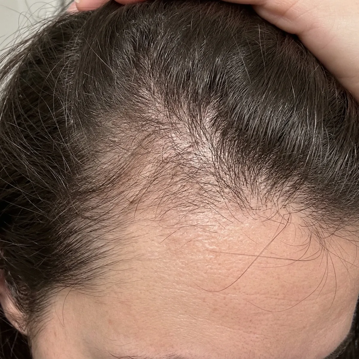After — Day 90