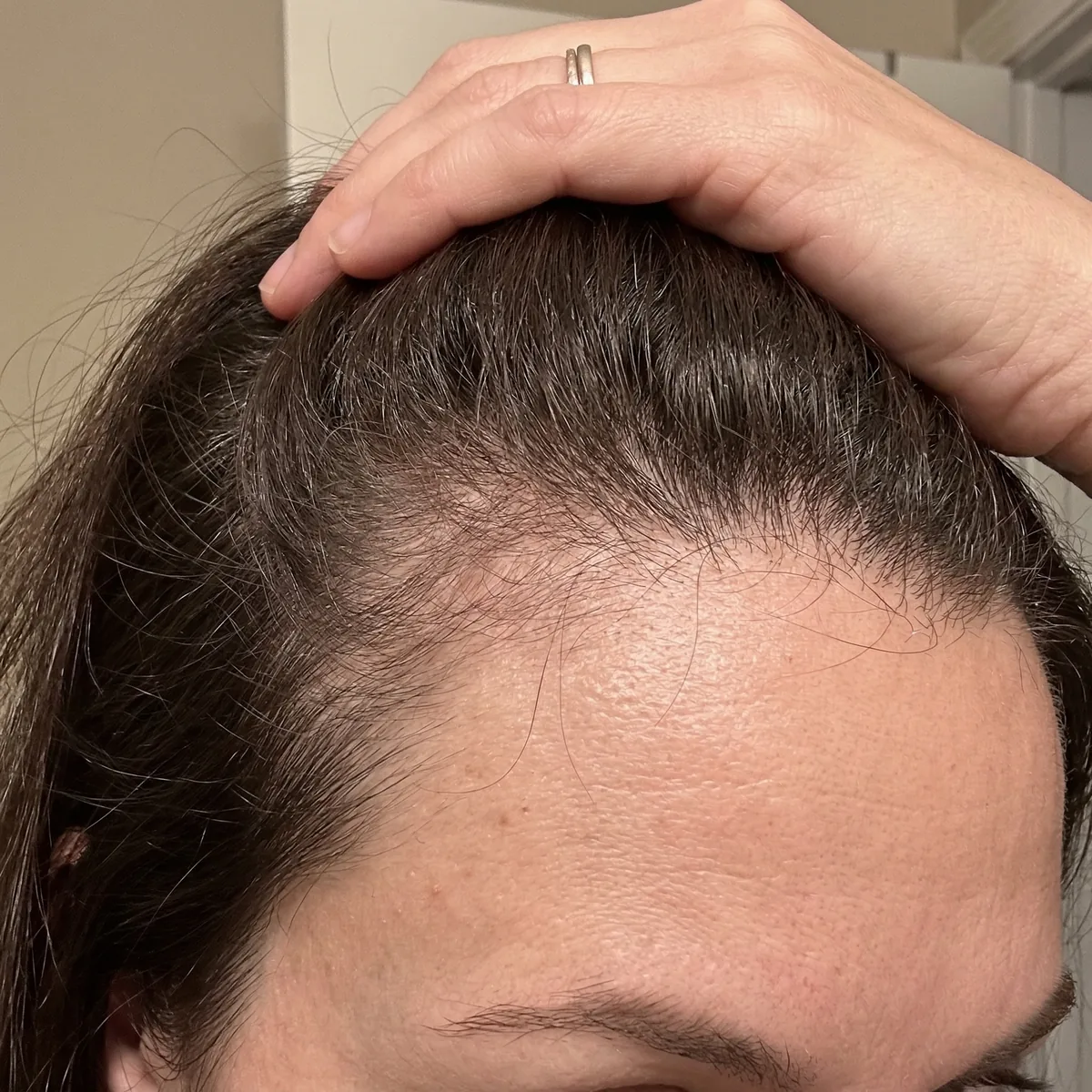 Before — Day 1