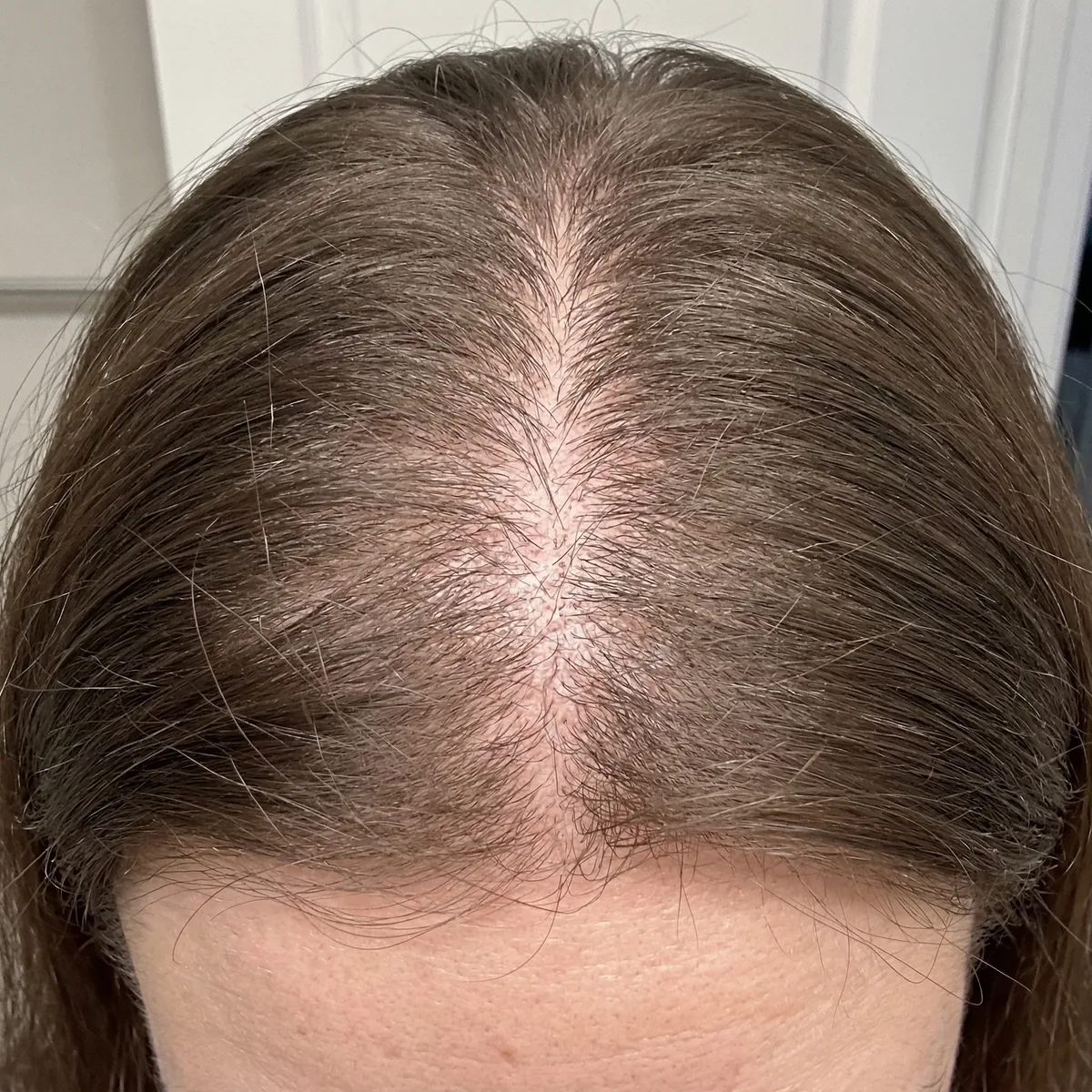 After — Day 90