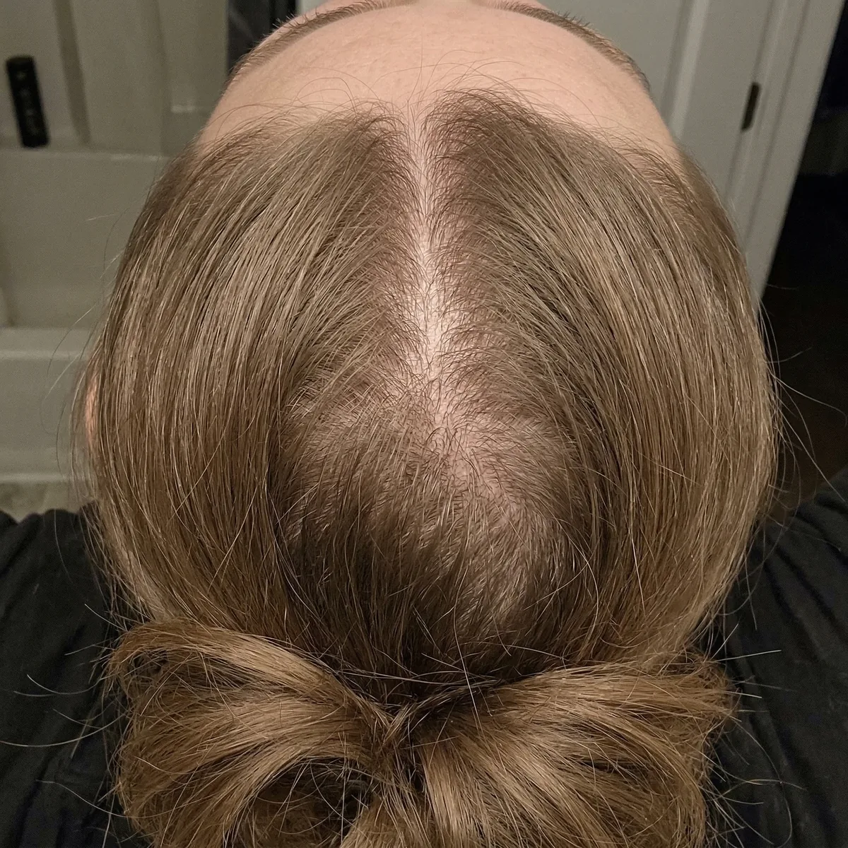 Before — Day 1